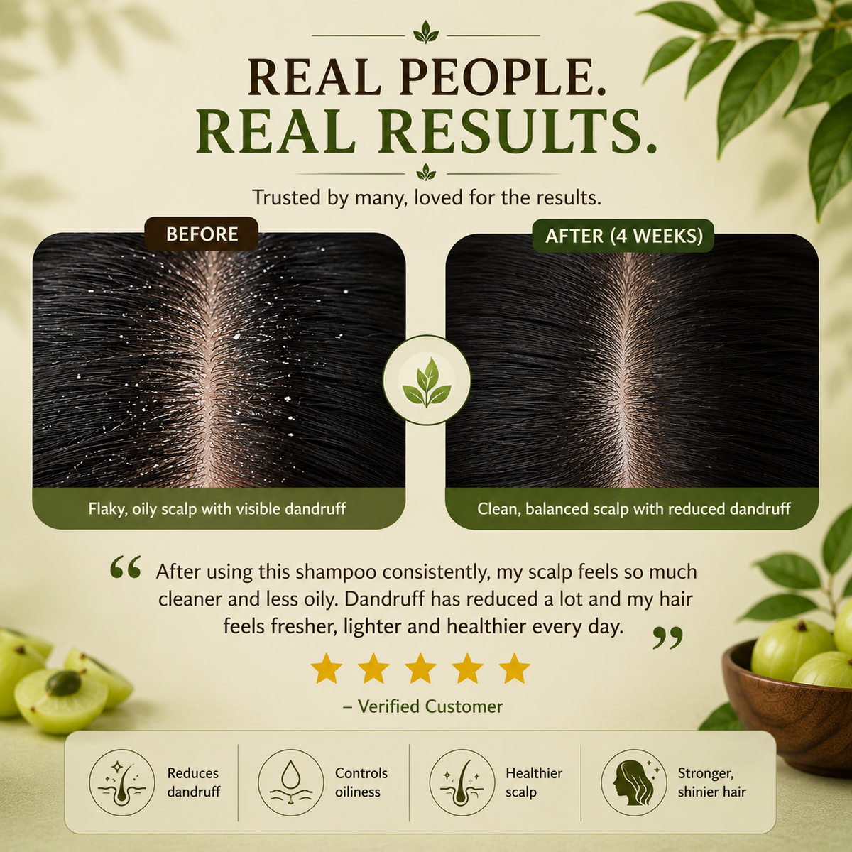 Amla Extract Shampoo | Ayurvedic Anti-Dandruff Shampoo for Healthy Scalp & Strong Hair