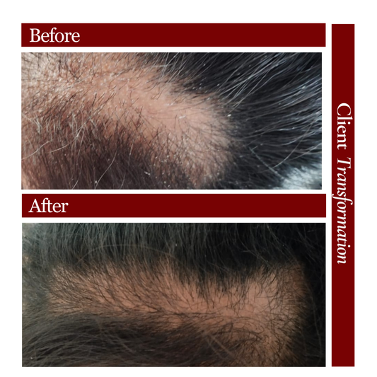 Pure Black Sesame Hair Oil | Best Seller Hair Oil | Ayurvedic Formulation | 100% Results