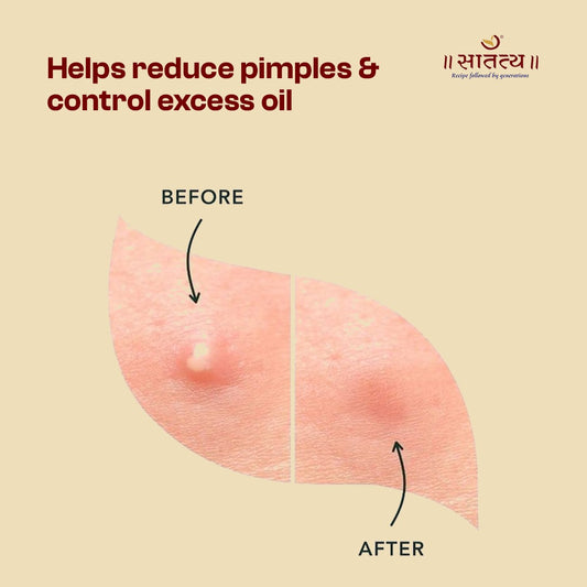 Pimples Pure Combo