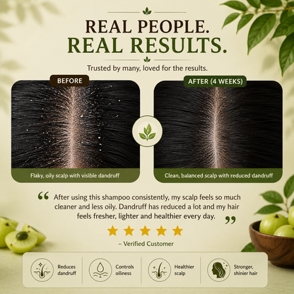 Amla Extract Shampoo | Ayurvedic Anti-Dandruff Shampoo for Healthy Scalp & Strong Hair
